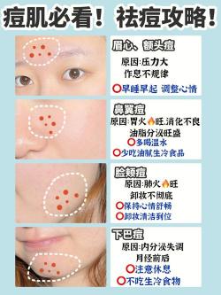 额头和下巴长痘痘的原因及处理方法