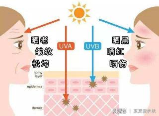 如何缓解皮肤晒斑：防晒、药物涂抹和激光治疗的选择