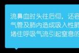 鼻孔出血时的处理方法：指压、冷敷、药物止血全攻略