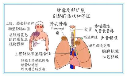 深入了解童样痴呆：症状、病因及治疗方法