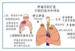 深入了解童样痴呆：症状、病因及治疗方法