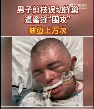 被蜜蜂蛰后如何快速消肿止痒？实用方法与注意事项