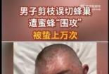 被蜜蜂蛰后如何快速消肿止痒？实用方法与注意事项