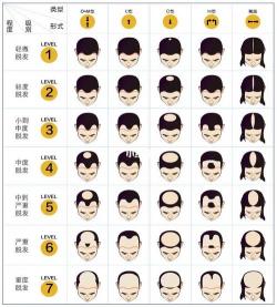 男性植发价格全攻略：从几千到几万，如何选对方案？