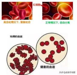 血液的奥秘：血细胞与血浆的协同作用，守护你的健康