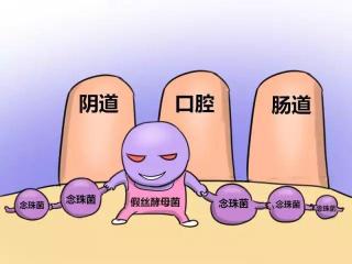 白色念珠菌感染：身体中的隐形威胁