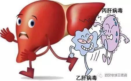 什么是脂肪肝：定义、症状与全方位治疗方法解析