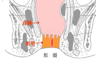 屁多屁臭是什么原因造成的？饮食与消化问题一网打尽！