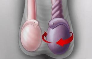 睾丸胀痛怎么办？日常保养与生活习惯改善全解析