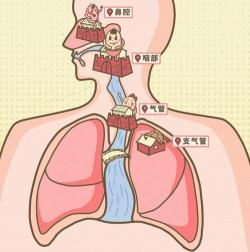 喉咙有异物感：原因、应对与预防方法