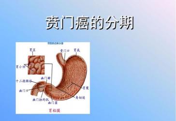 全面了解喷门癌：从预防到治疗，守护您的健康