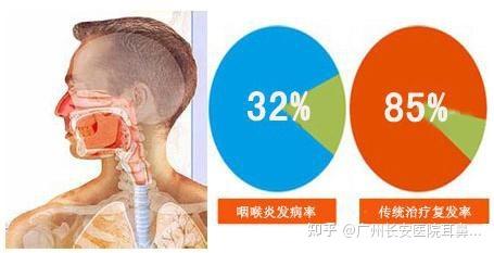 咽炎症状：了解症状，及时治疗