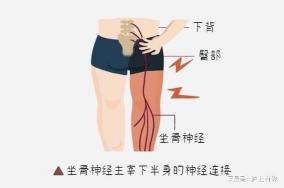 弯腰疼的原因与缓解方法